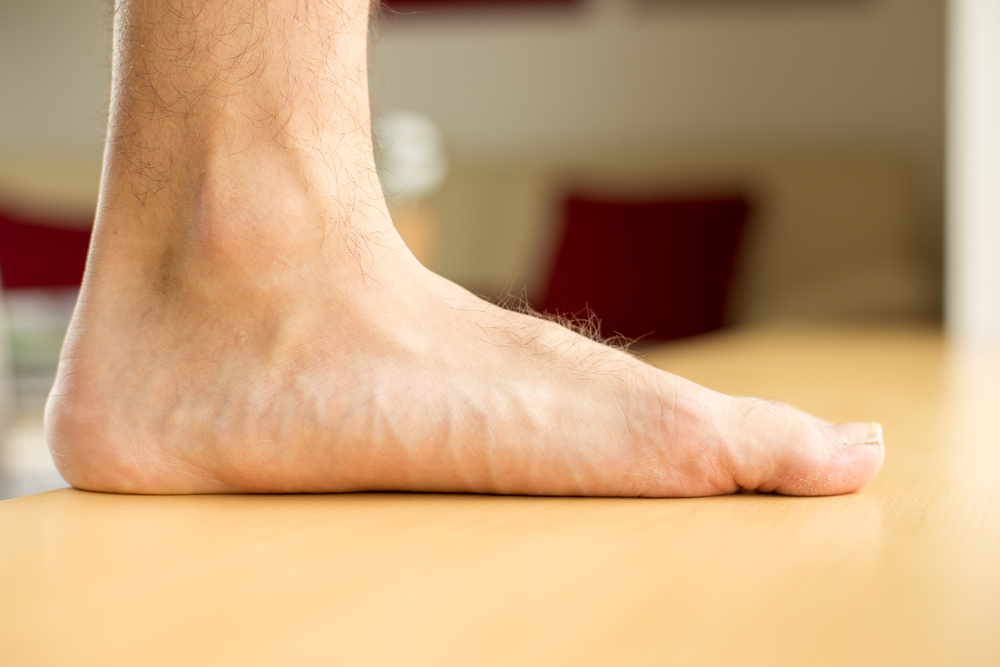 Flat Feet  Scottsdale, AZ 
